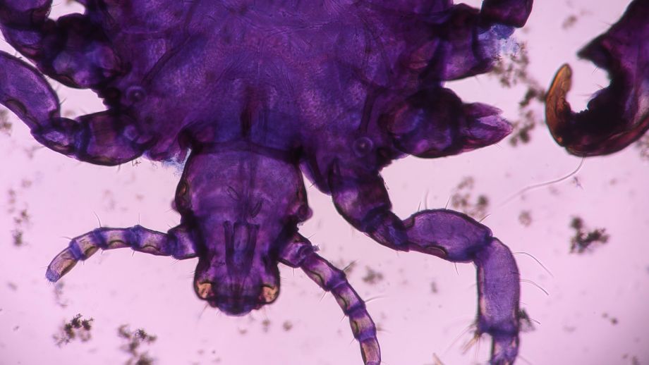 Microscopic image of parasites